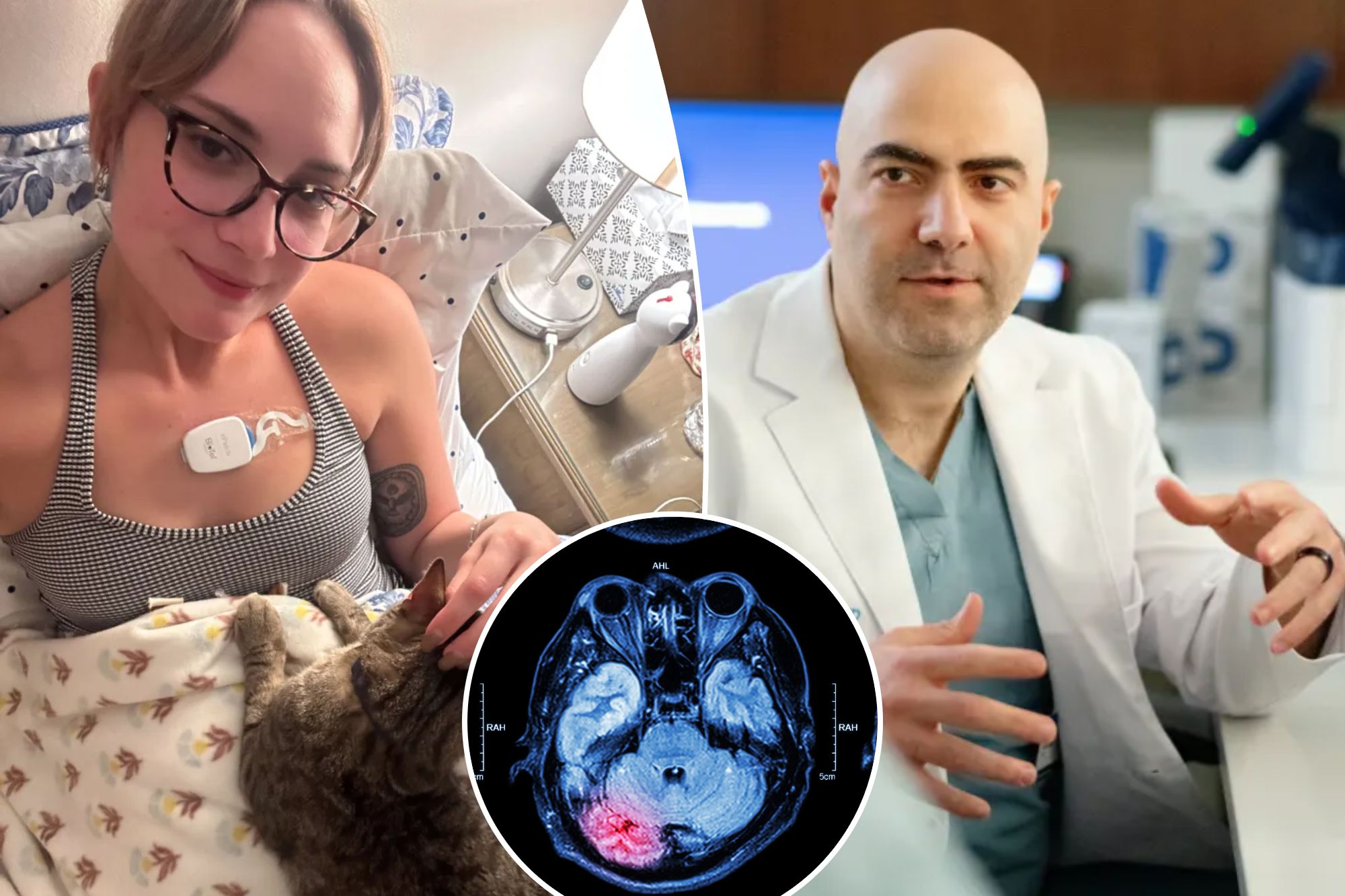 Why so many people have stroke accidents at the age of twenty, 30 and 40: "We have never had such young patients"